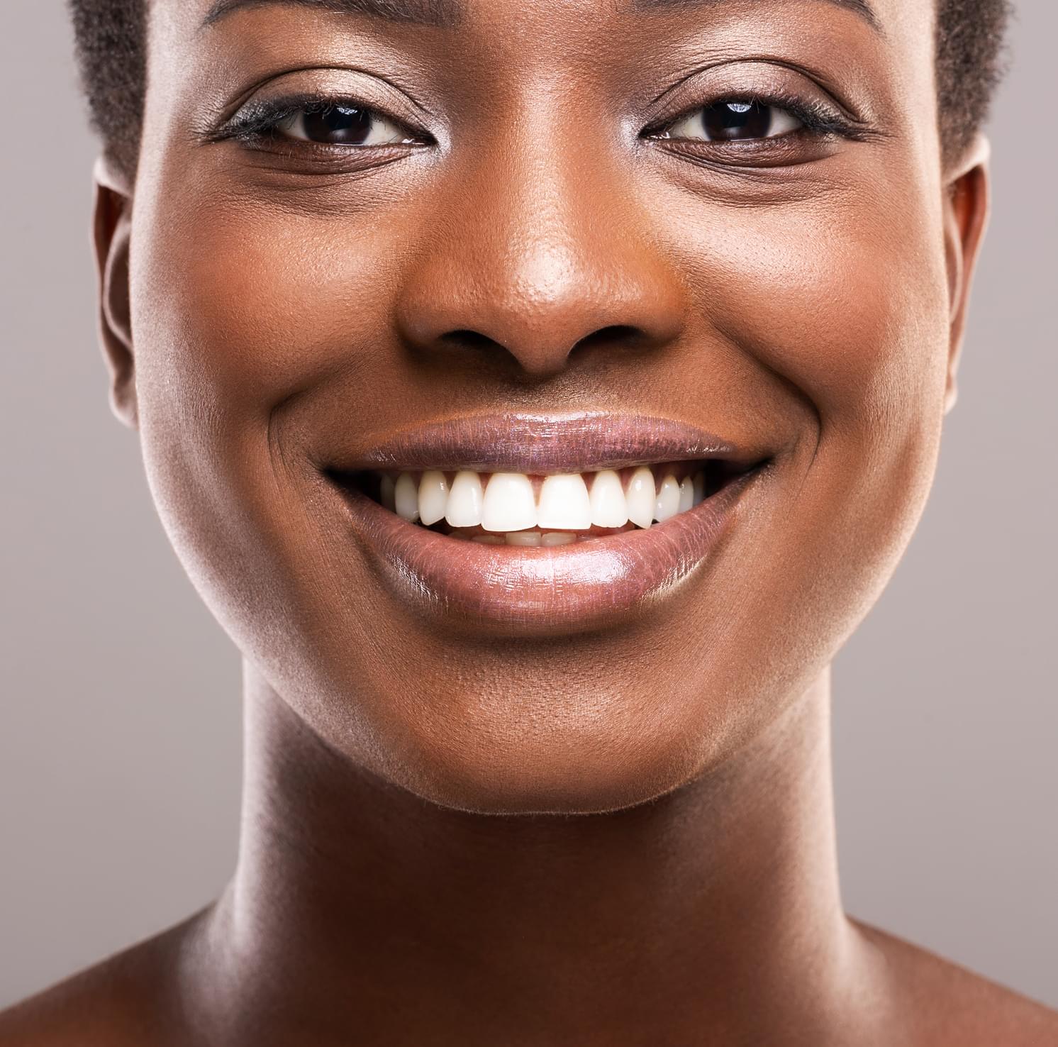 Cantilever Dental Bridge