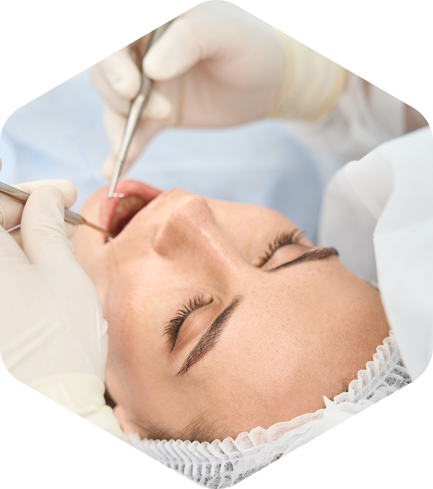 Dental Extractions