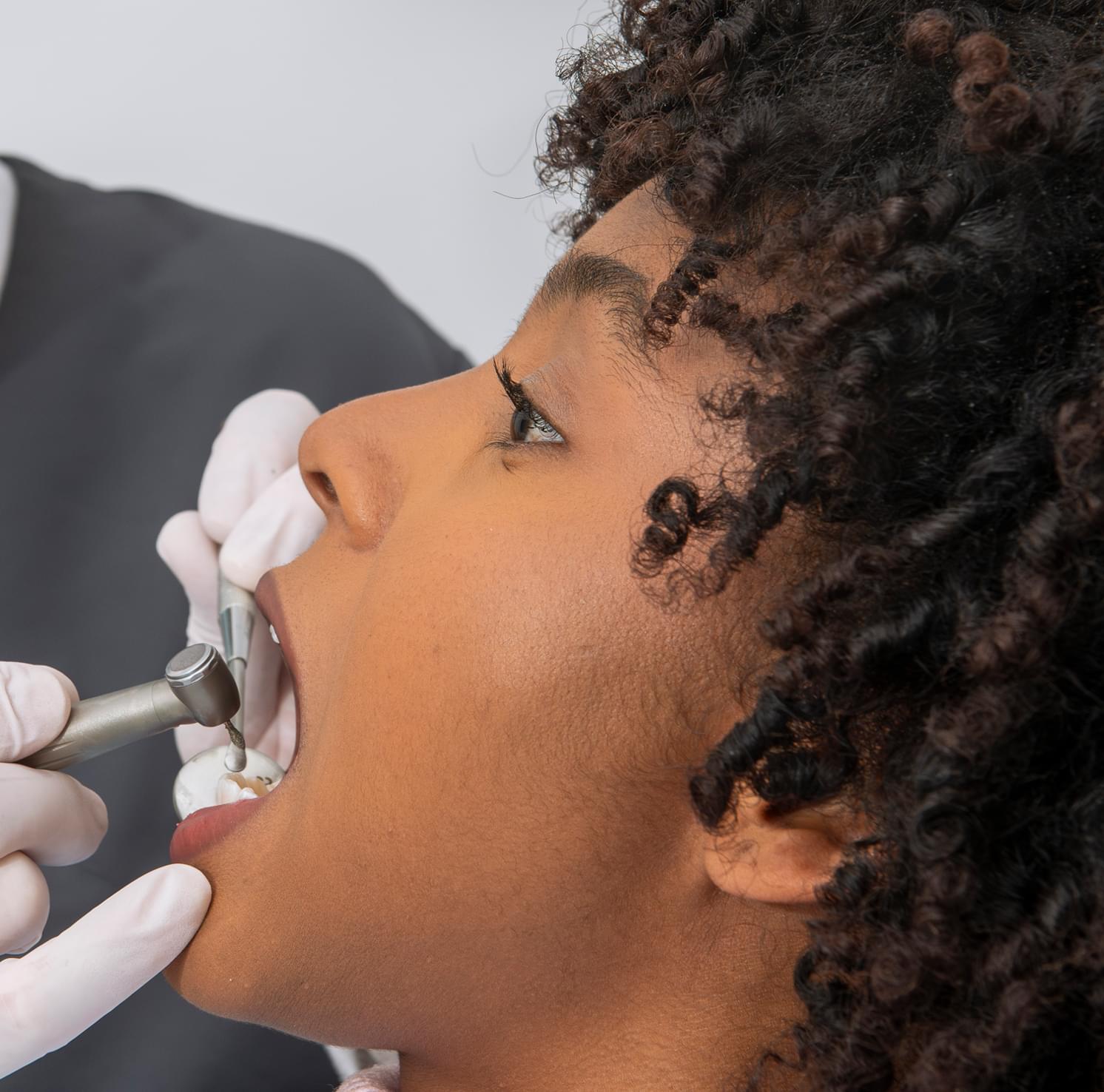 Tooth Removal