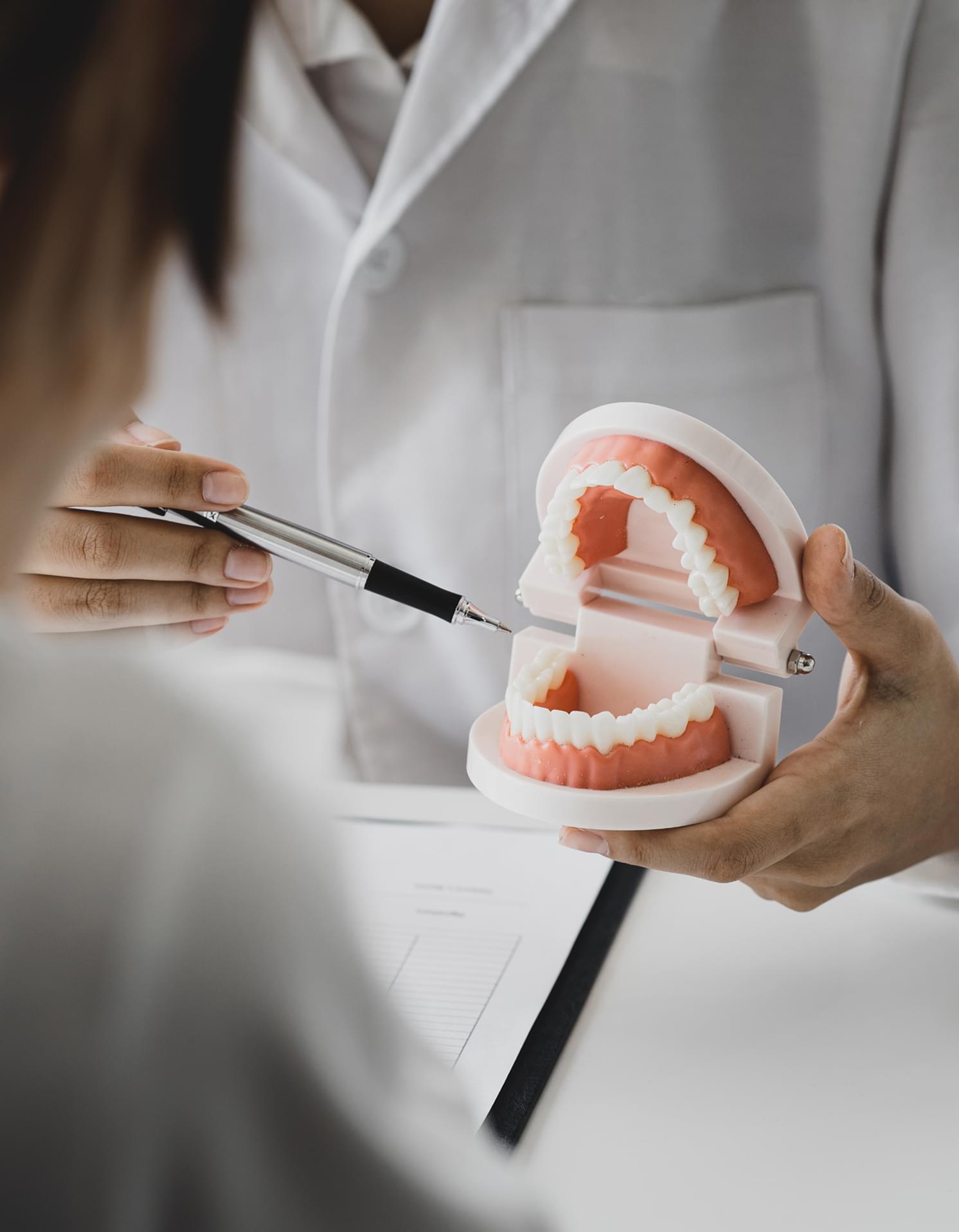 All on X Dental Implants