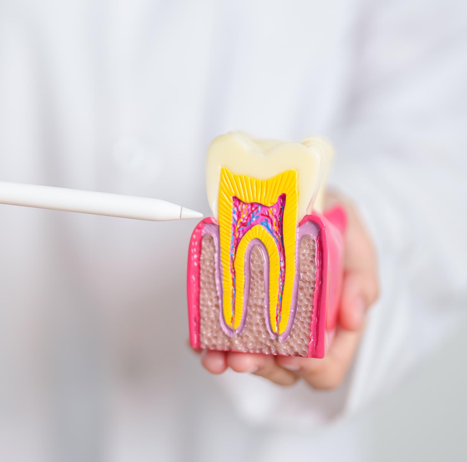 Root Canal Therapy