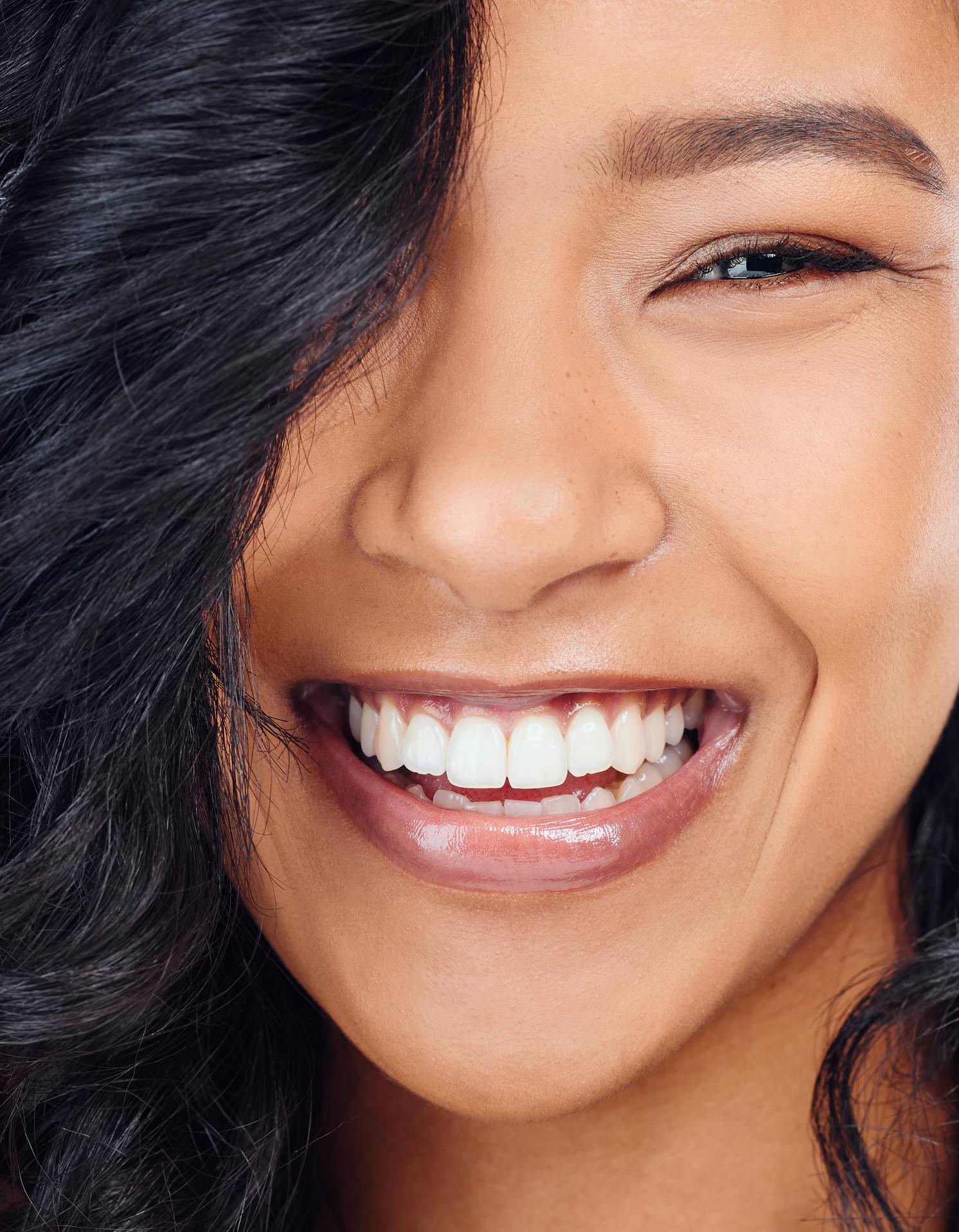 Dental Whitening