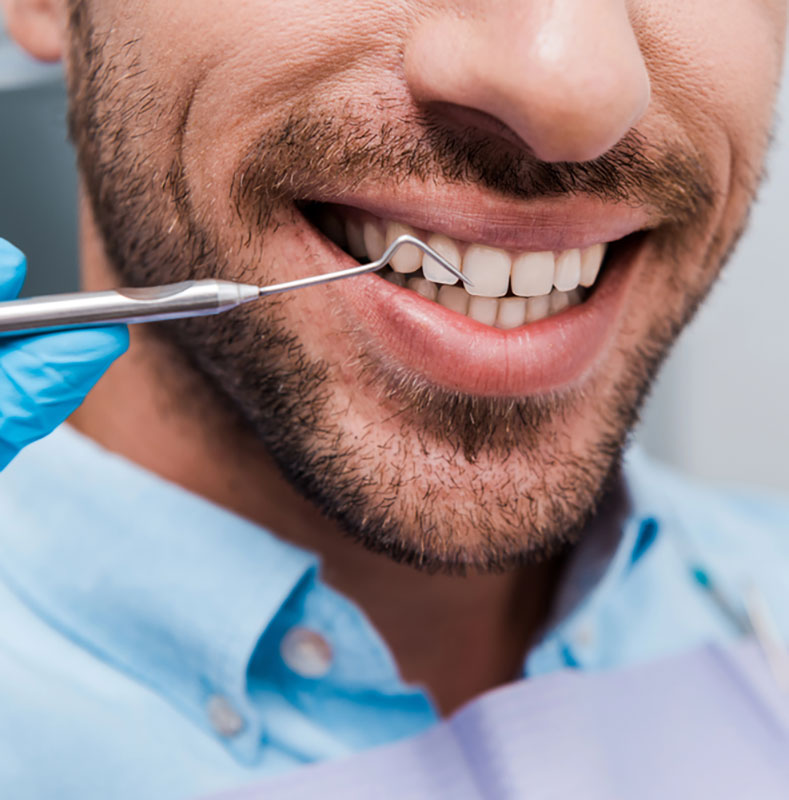 Mouth Guard for Grinding Teeth